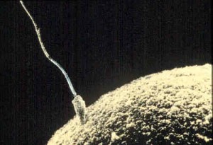 Spermatozoid Spermatozoid